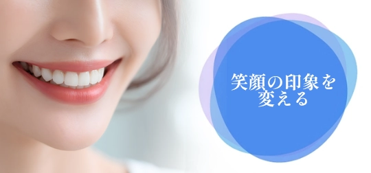 セラミック矯正で笑顔に自信を