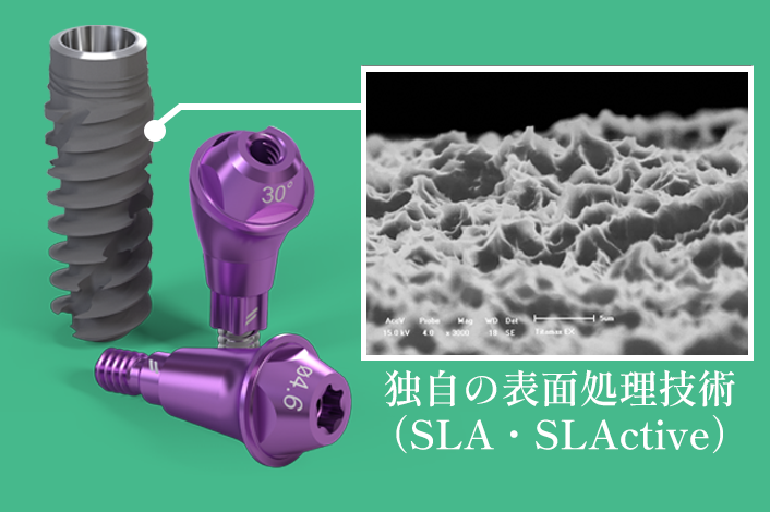 インプラント構造図と歯の構造図