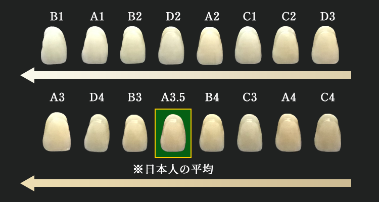 シェードガイド