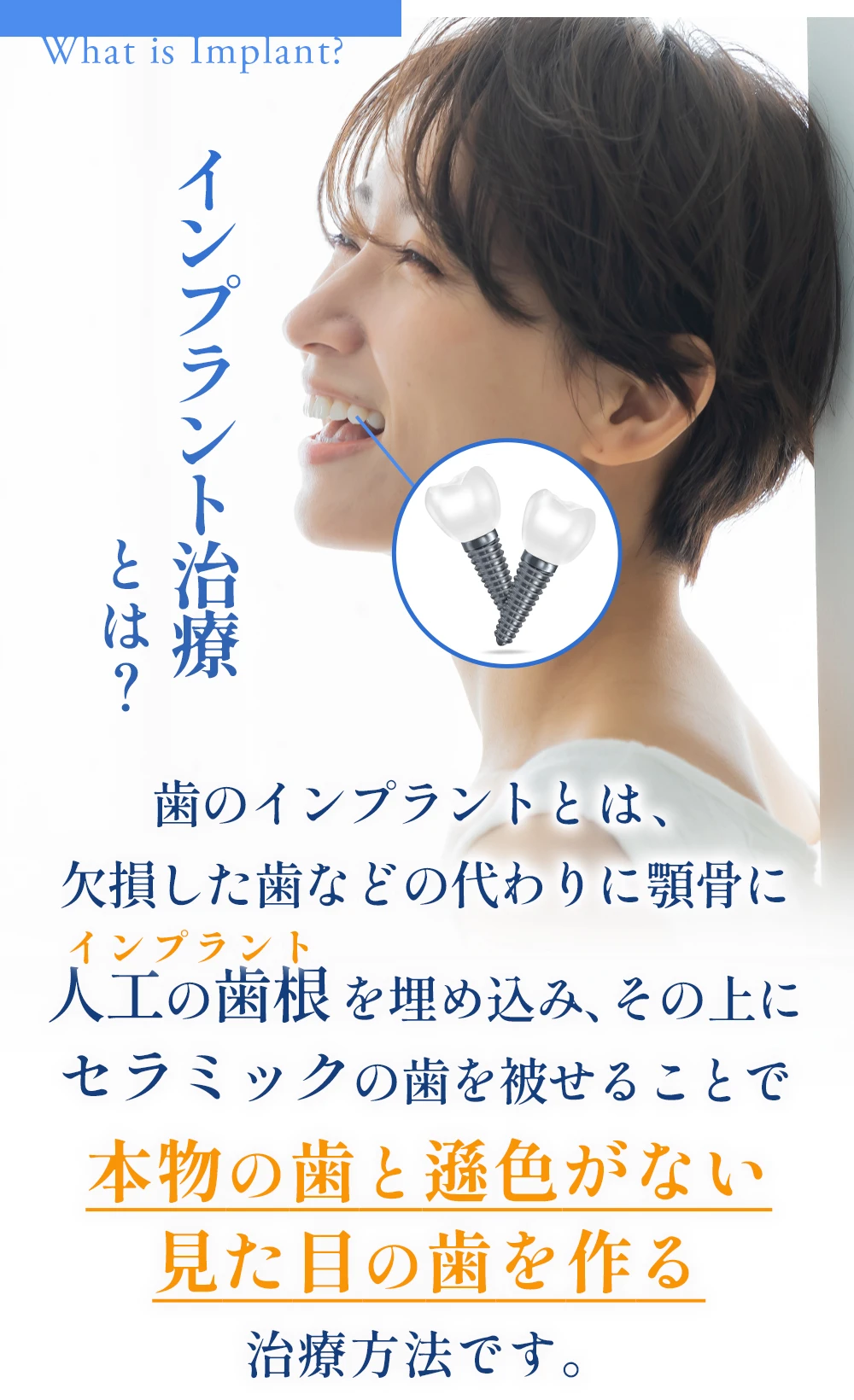 本物の歯と遜色ない見た目の歯を作る治療です