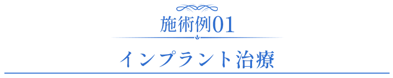 セラミック症例01