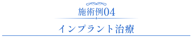 セラミック症例04