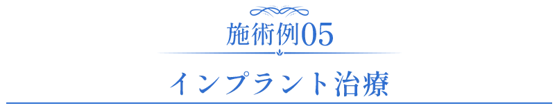 セラミック症例05