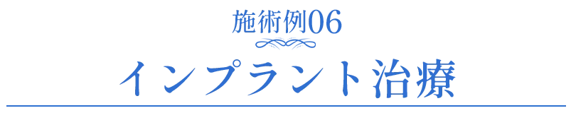 セラミック症例06