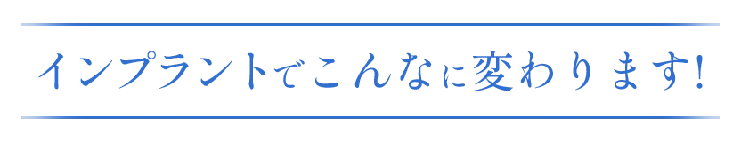セラミックでこんなに変わります!