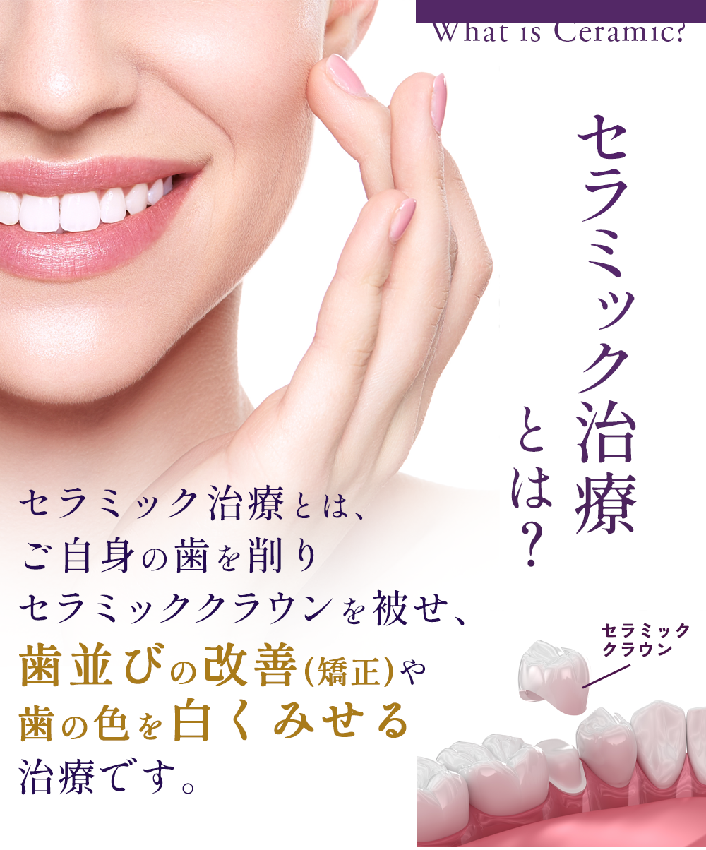 歯並びの改善や歯の色を白くみせる治療です