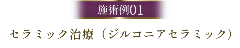 セラミック症例01