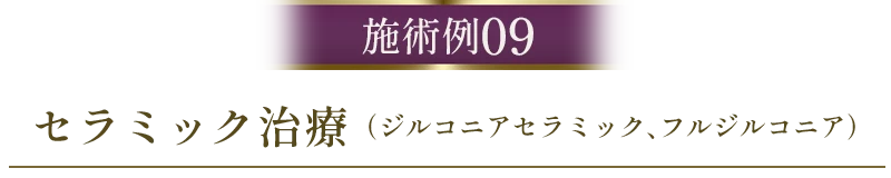 セラミック症例09